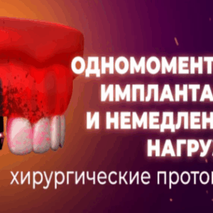 Кларк Бринтон, Эдуардо Монтеро – Одномоментная имплантация