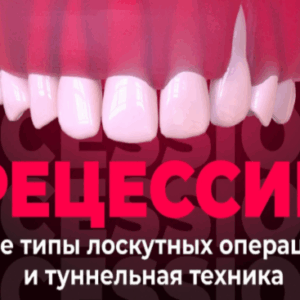 Л. Чамброне, Н. Карранза – Лечение рецессии