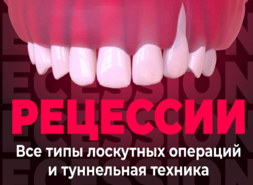 Л. Чамброне, Н. Карранза – Лечение рецессии