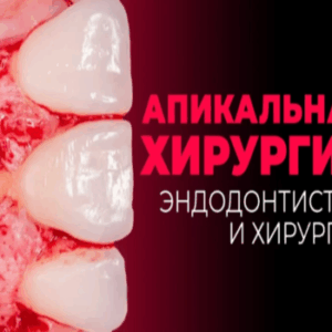 Паула Вилла, Фелипе Рестрепо – Апикальная хирургия