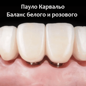 Пауло Карвальо – Баланс белого и розового. Успешная имплантация
