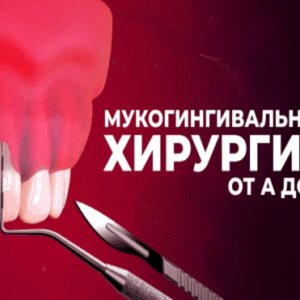 Роберт да Силва, Ильхам Мунссиф – Мукогингивальная хирургия
